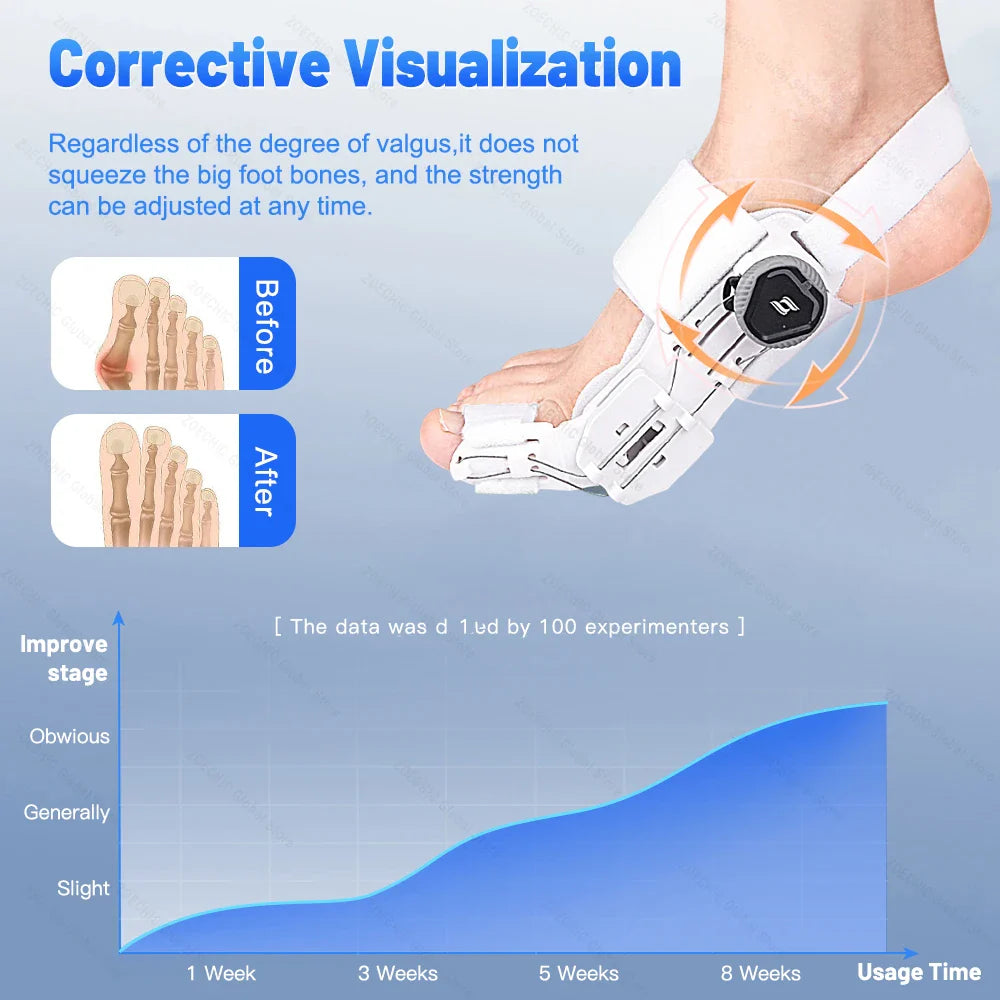 Povei Bunion Corrector Toe Separator Straightener Hallux Valgus Relief Protector