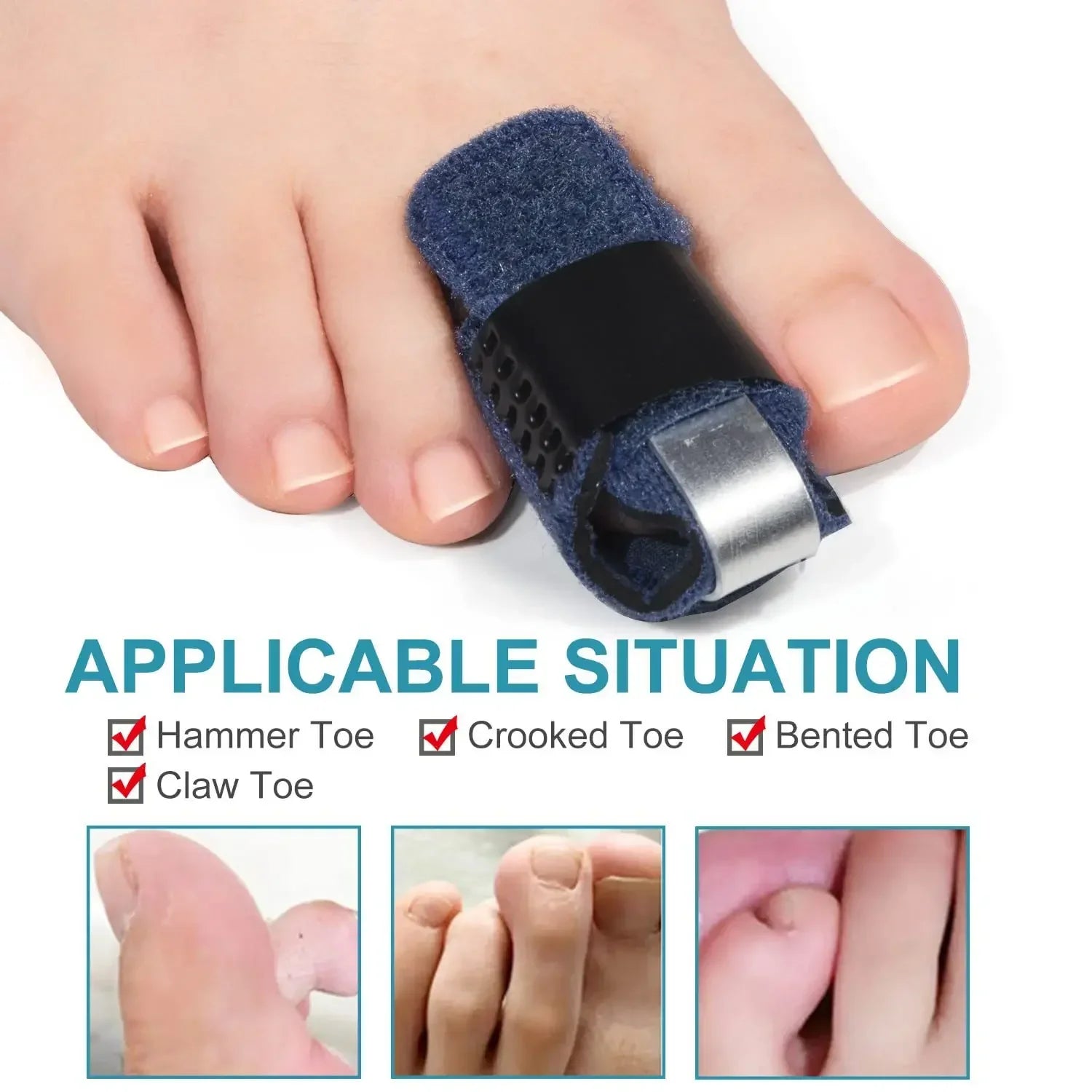 Povei Toe Corrector Finger Splint Fracture Pain Relief Brace Thumb Protector Support