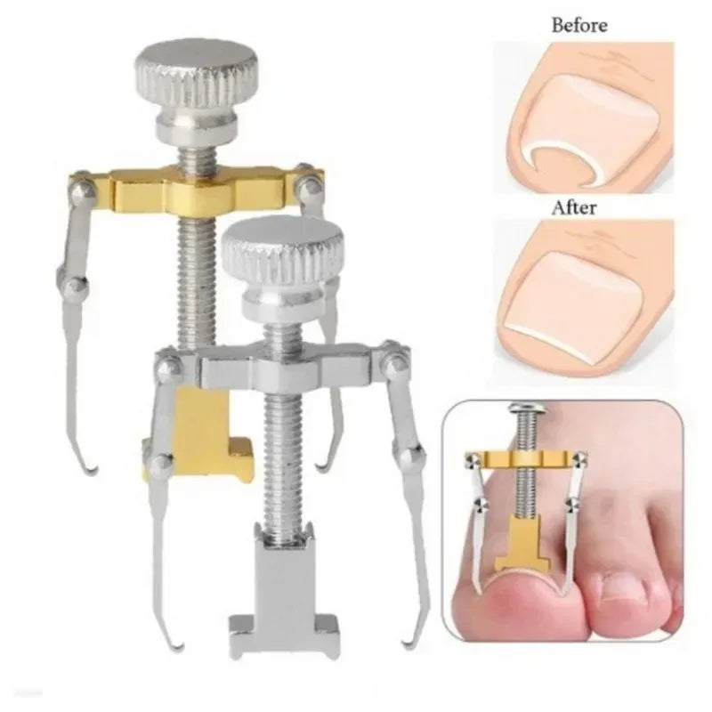 Povei Toe Nail Correction Bracket for Paronychia Treatment and Care with Fixator