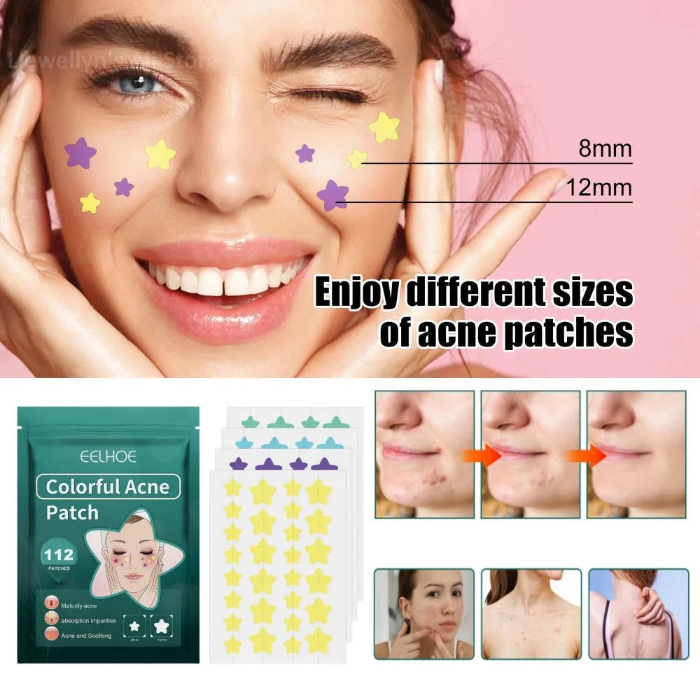 Povei Color Star Hydrocolloid Acne Patches - Acne Concealer Spot Bandages