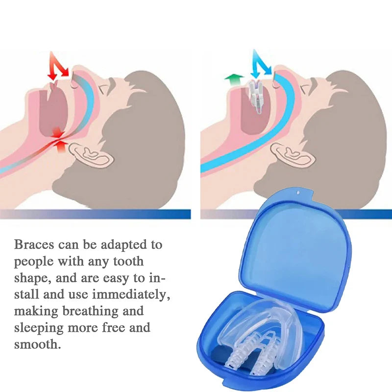 Povei Snore Stopper & Teeth Grinding Gum Shield Set for Better Sleep