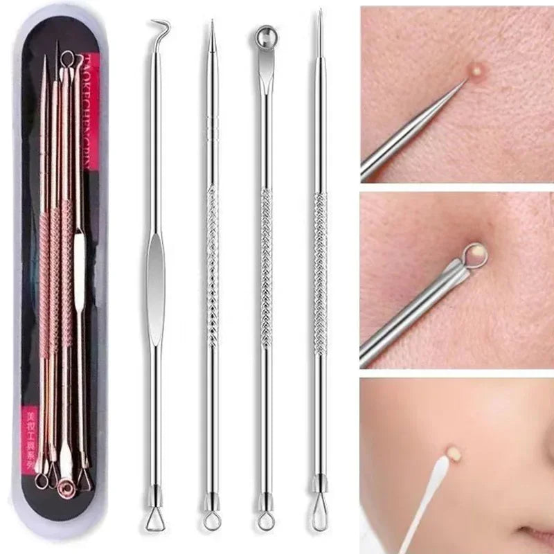 Povei Acne Blackhead Removal Needles Set - Deep Cleansing Tool for Clear Skin